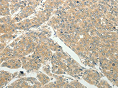 SLC8A3 Antibody