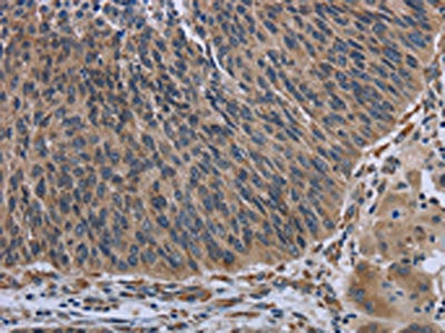 AVEN Antibody