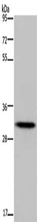 HOXB8 Antibody