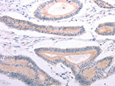 ANGPTL2 Antibody