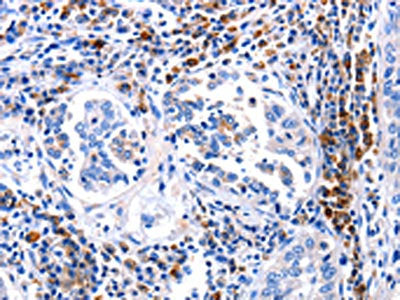 DOK3 Antibody