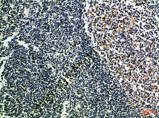 CD52 Antibody