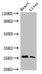 Tnni3 Antibody