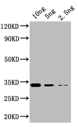 KNAT5 Antibody