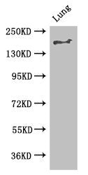 TSC2 Antibody