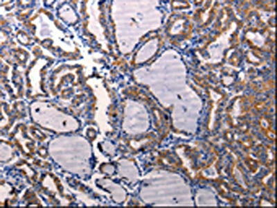 DRD1 Antibody
