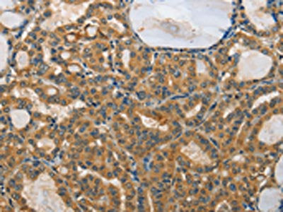 RPS27 Antibody