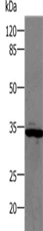 CA1 Antibody