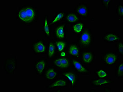 MAP3K7CL Antibody