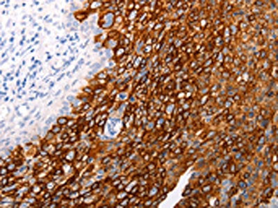 ABCA4 Antibody