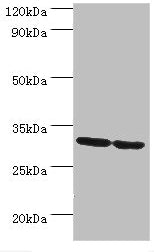PNP Antibody