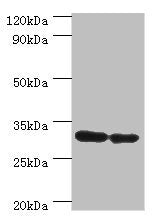 PNP Antibody