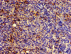 HLA-C Antibody