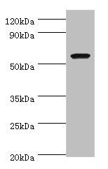 AMY1A Antibody