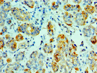 AMY1A Antibody