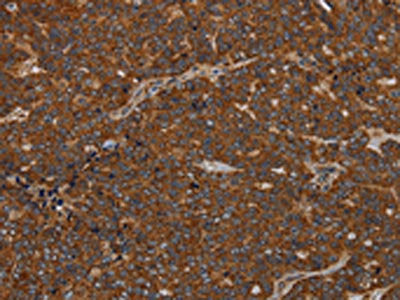 GDF2 Antibody