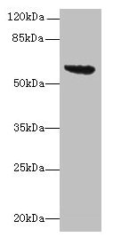 tar Antibody