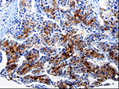 FTH1 Antibody
