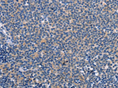 CTSC Antibody