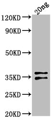 ARCA Antibody