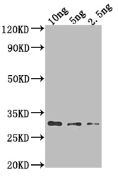 AADB Antibody