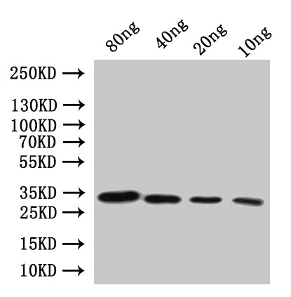Diphtheria toxin Antibody