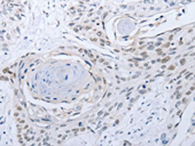 CAMK2B Antibody
