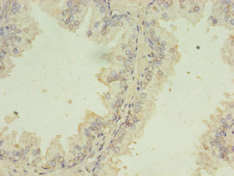 SNRPB2 Antibody