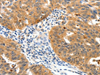 TPM2 Antibody