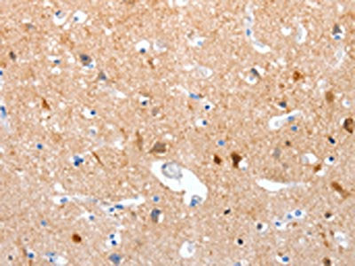 GPR6 Antibody