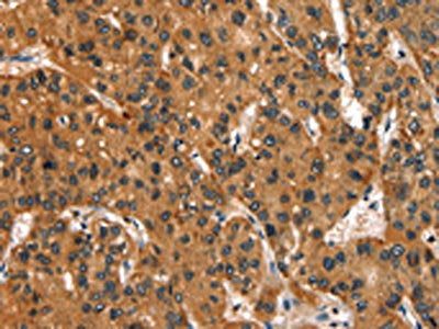 SLC6A4 Antibody