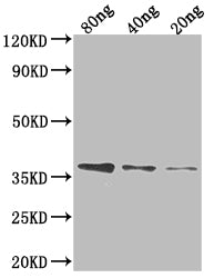 FTSI Antibody