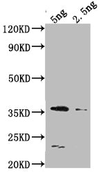DCM Antibody