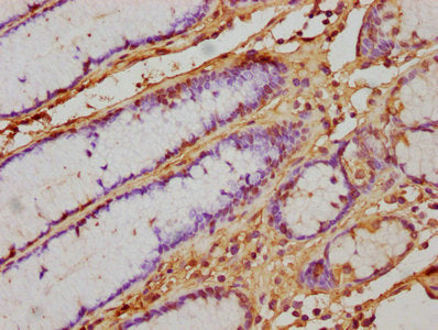 IFNA1 Antibody