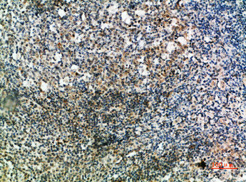 IGHD Antibody