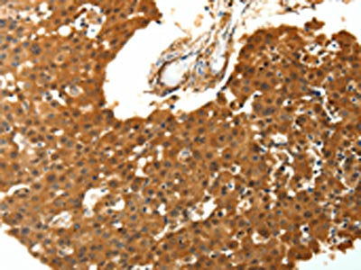 SKP1 Antibody