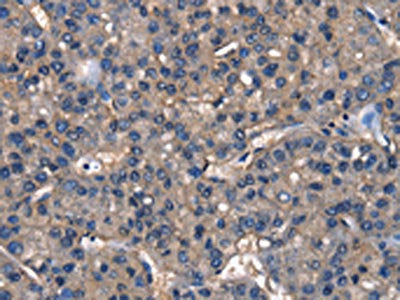 IGFBP5 Antibody