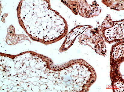 UBB/UBC/RPS27A/UBA52 Antibody