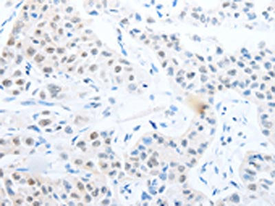 POU2F1 Antibody