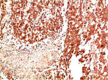 MET Antibody
