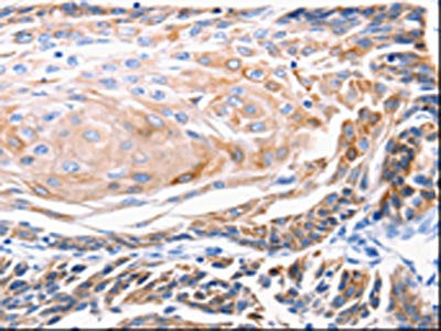 KRT5 Antibody