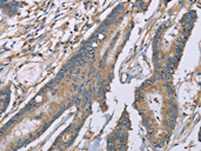 SASH1 Antibody