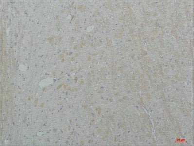 CACNA1B Antibody