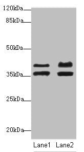 IKBIP Antibody