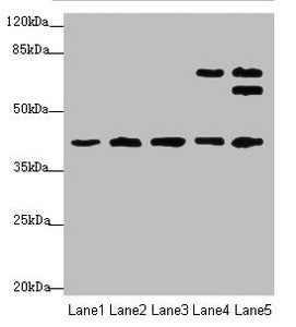 IKBIP Antibody