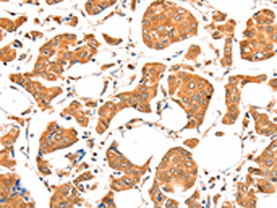 ACSM5 Antibody