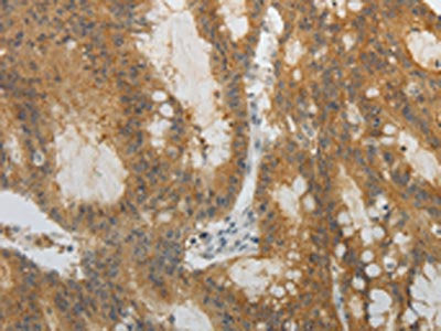 OCLN Antibody