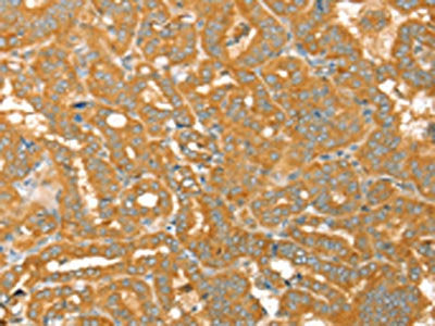 PTPN22 Antibody