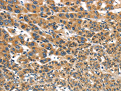 UBTD2 Antibody
