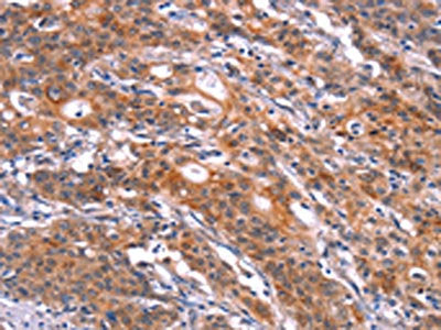 FEM1A Antibody